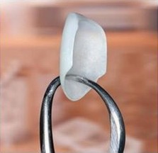 A porcelain veneer is held up close with a tool to show its thinness and shape.