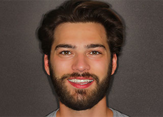 smile gallery headshot